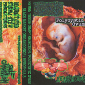 Hymen Tissue Graft Rejection / Polycystic Ovum / Black Market Organ Donor / Herophilus
