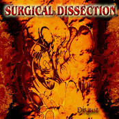 Manipulation Lines by Surgical Dissection