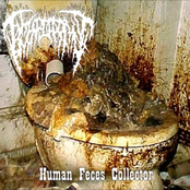 Human Feces Collector
