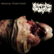 Manual Penectomy