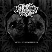 Afterlife and Seizures