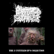 The 3 Untitled EP's Collection
