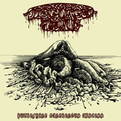 Putrefying Gangrenous Abscess