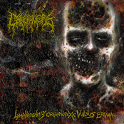 Lymphadenitis Organopexic Vulnus Edema