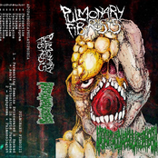 Split Tape