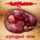 Unplugged Anus