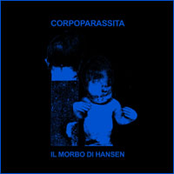 Il Morbo Di Hansen
