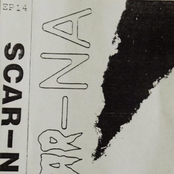 Scar-Na