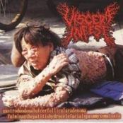 Viscera Infest / Paracoccidioidomicosisproctitissarcomucosis (Split)