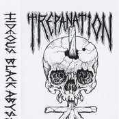 Nuclear Disembowelment by Trepanation