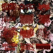 crackwhores infesting the sewers