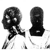 ESTRANGULADOR