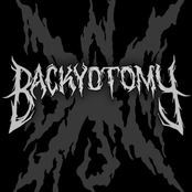 backyotomy