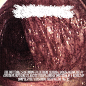 The Inevitable Succumbing to Extreme Cerebral Degradation due to Constant Exposure to Accute Toxoplasmosic Infection as a result of Compulsively Consuming Fresh Feline Faeces