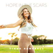 Hope in the Scars