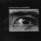 Unnatural Bleeding