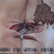 Barbed Wire Genital Torture