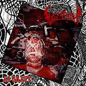 Dying Fetus by Cerebral Turbulency