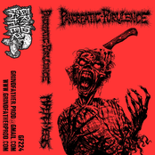 Hyperemesis ‎/ Pancreatic Purulence