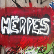 hërpes