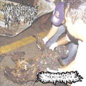 Hymenolepiasis / Necrotool