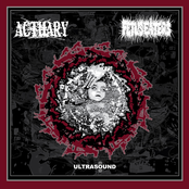 Fetus Eaters / Actuary