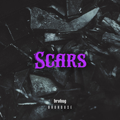 Scars