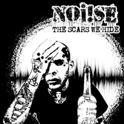 Noi!se: The Scars We Hide