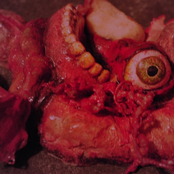 Exposure to the Preliminary Output of Radiation Causing Interior Damage to the Ear