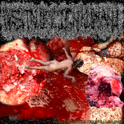 Pus Leak In The Cerebral Badge