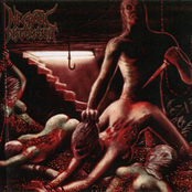 Razorblade Catheter by Necrotic Disgorgement