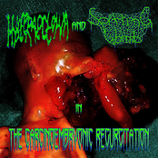 The Carcinoembryonic Regurgitation