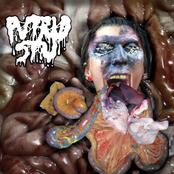 Amidst An Anal​-​Analgesic Assembly