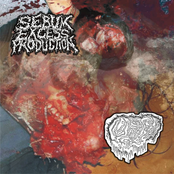 Tracks Off Split W/ Fetal Deformity