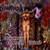 Extirpacion Visceral [Demo] (2009)