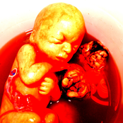 Red Love Hospital Collection