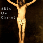 SKINOVCHRIST