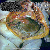 Butchers Knife Bodily Dissection