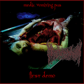 1st demo