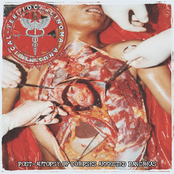 POST-AUTOPSY OF CORPSES AFFECTED PANCREAS