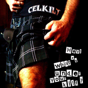 Hey! What's Under Your Kilt?