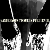Gangrenous Tissue in Purulence