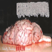 Totally Fucking Brain Dead
