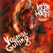 Vaginal Gutting