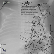 Respiratory Distress
