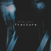 Fracture - Single