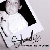 Shameless: Smokers Die Younger