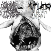 Amputee Stillborn Molester / Mutilated Infant split