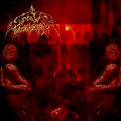 Putrid Human Dejection by Spiritual Dissection