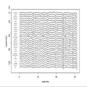 A few sequential electroacoustic contributions